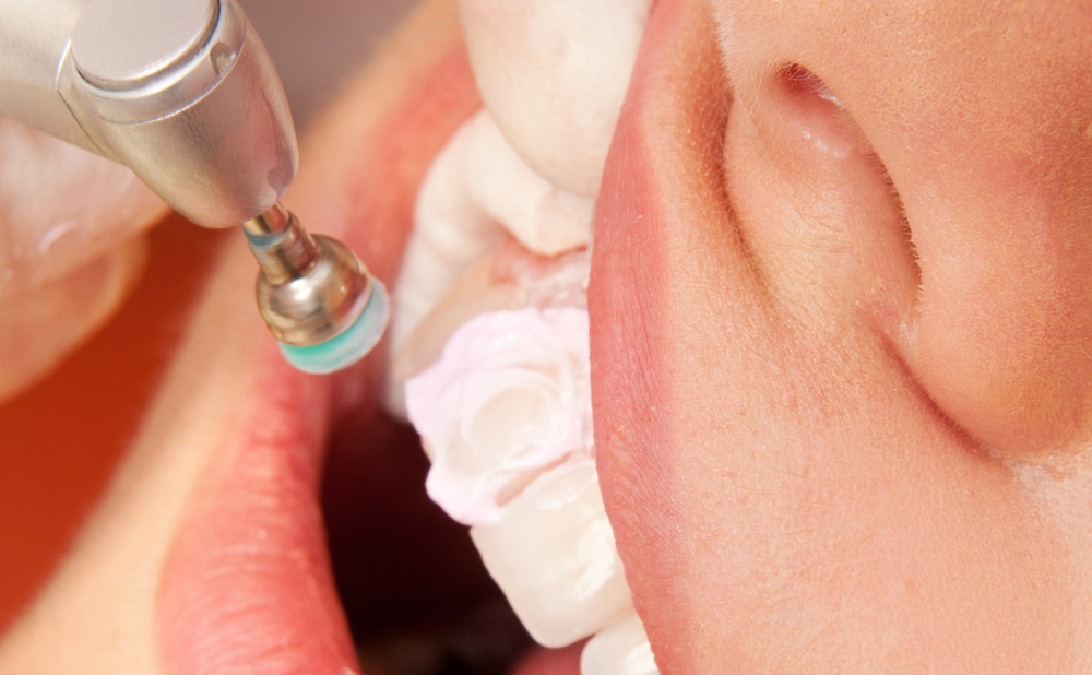 UC1596_3 - Realizar las técnicas odontológicas propias, delegadas o de ayuda dentro del equipo de salud bucodental